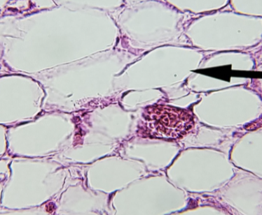 <p>what kind of tissue is this </p>