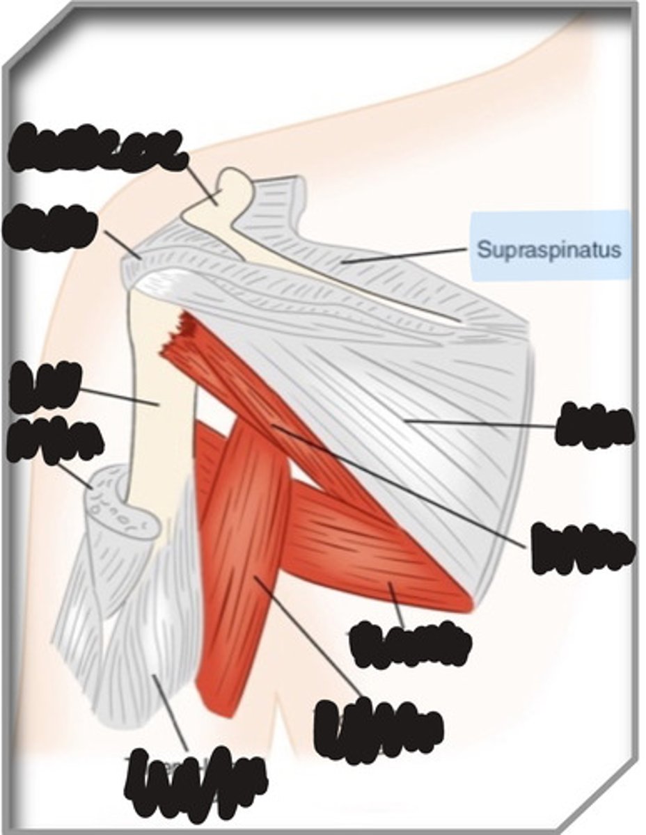 <p>What muscle is this?</p>
