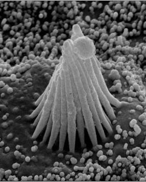 <p>scanning electron microscope, surface detail </p>
