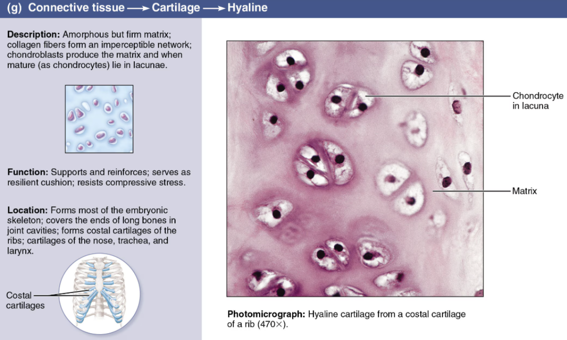 <p><span style="color: red"><strong>Cartilage</strong></span></p><p></p><ul><li><p><strong>DESCRIPTION</strong>: Firm ground substance containing collagen fibers</p></li><li><p><strong>FUNCTION</strong>: <span style="color: red">Resists compression well</span></p></li><li><p><strong>LOCATION</strong>: Found in <span style="color: green"><strong>embryonic</strong></span><span><strong> </strong></span><span style="color: green"><strong>skeleton</strong></span>, at <span style="color: green"><strong>articulating surfaces of bones</strong></span>, <span style="color: green"><strong>costal cartilages</strong></span>, and in the <span style="color: green"><strong>trachea</strong></span>; most abundant type</p></li></ul><p></p>