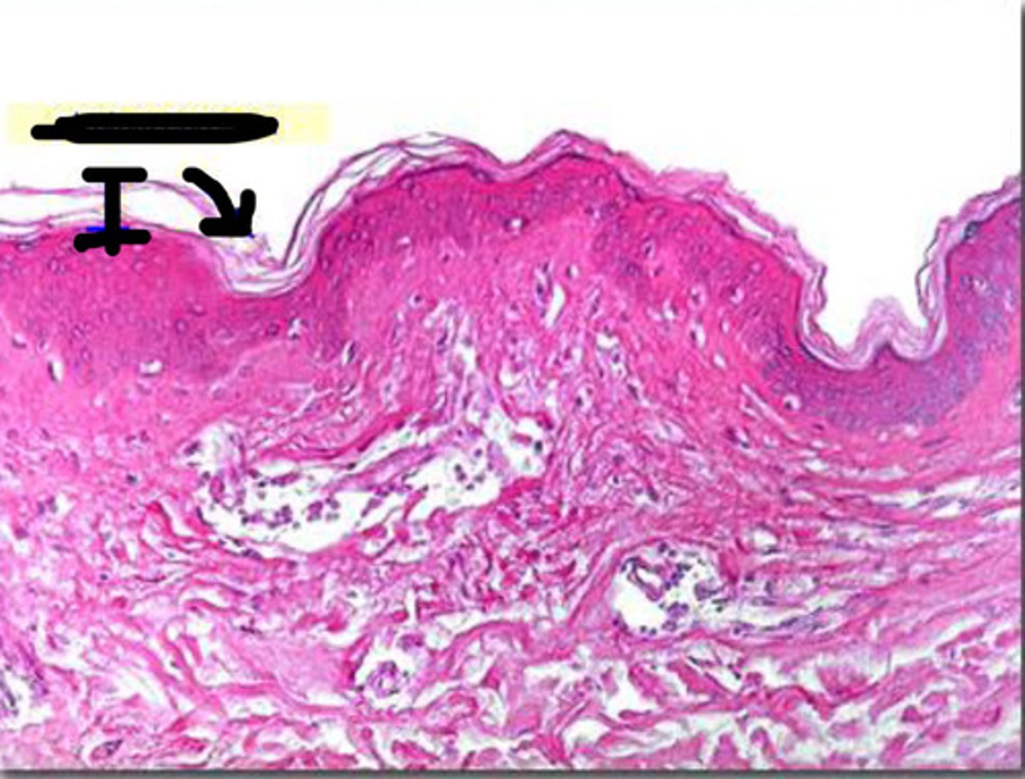 <p>Covers most of the body</p><p>Has four layers of keratinocytes</p>