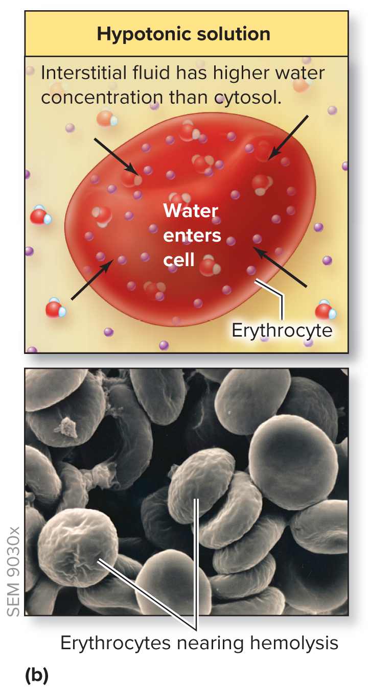 <p>Water comes in the cell → hemolysis (CELL GROWS)</p><p>In: More concentration</p><p>Out: Less concentration</p>
