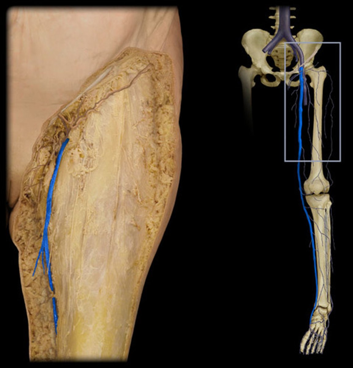 <p>-lower extremity (pelvis, anterior and medial thigh)</p>