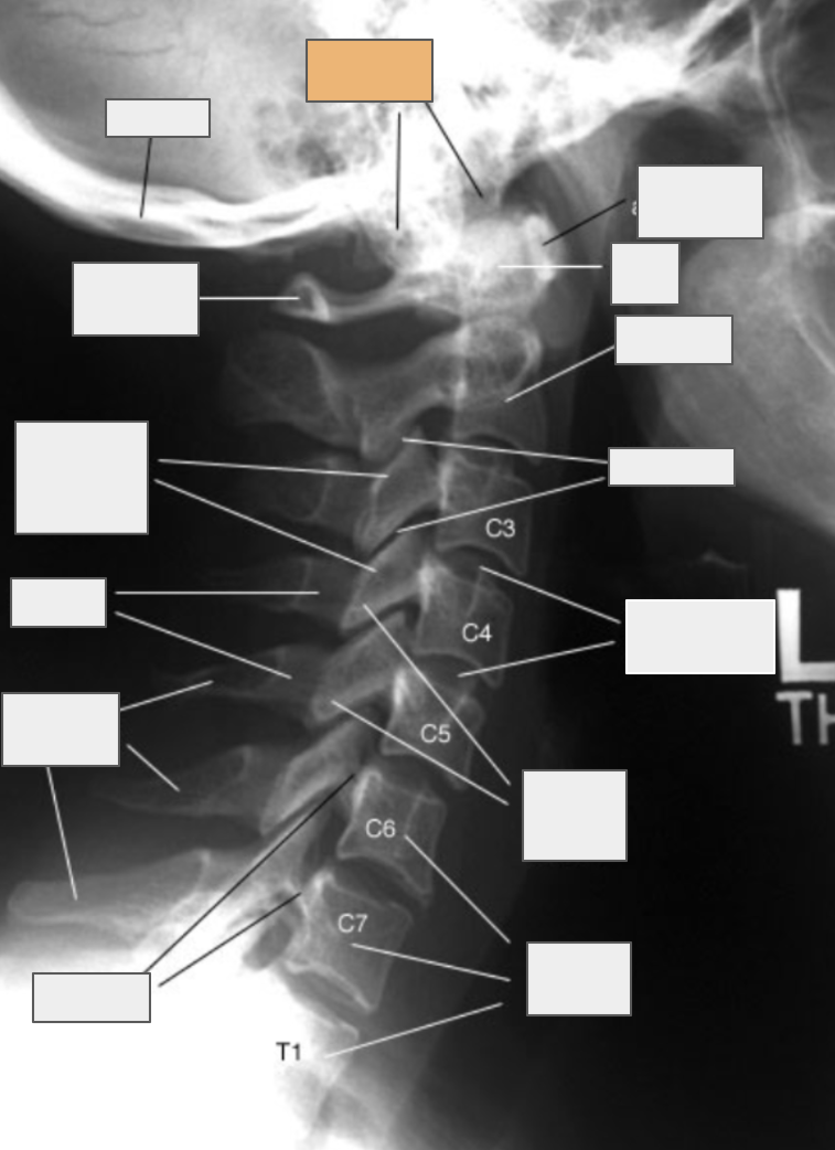 <p>What structure of the spine does the box highlighted in orange reference to?</p>