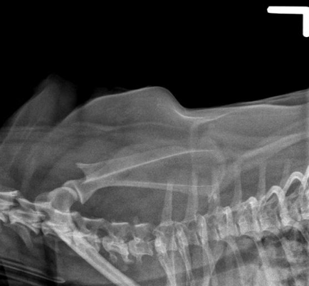 <p>what view of the scapula is shown?</p>