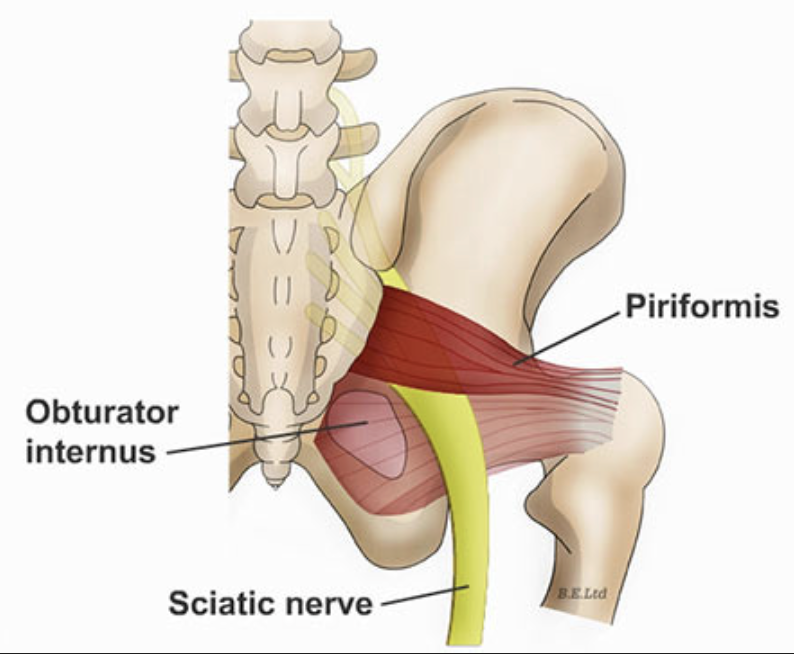 <ul><li><p>lesser pelvis muscle</p></li><li><p><strong>origin</strong>: sacrum</p></li><li><p><strong>insertion</strong>: greater trochanter (lateral femur)</p></li><li><p>“flat, pyramidal muscle arising from anterior sacrum, passing through greater sciatic notch to insert into superior aspect of greater trochanter of femur; serves to rotate and abduct the thigh”</p></li><li><p>associated with piriformis syndrome (baby pressing on pelvis —> piriformis compressing on nerve, causing nerve injury)</p></li></ul><p></p>