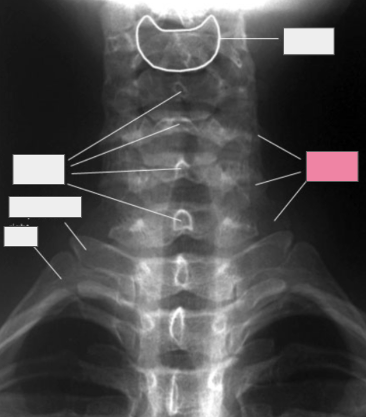 <p>What structure of the spine does the box highlighted in pink reference to?</p>