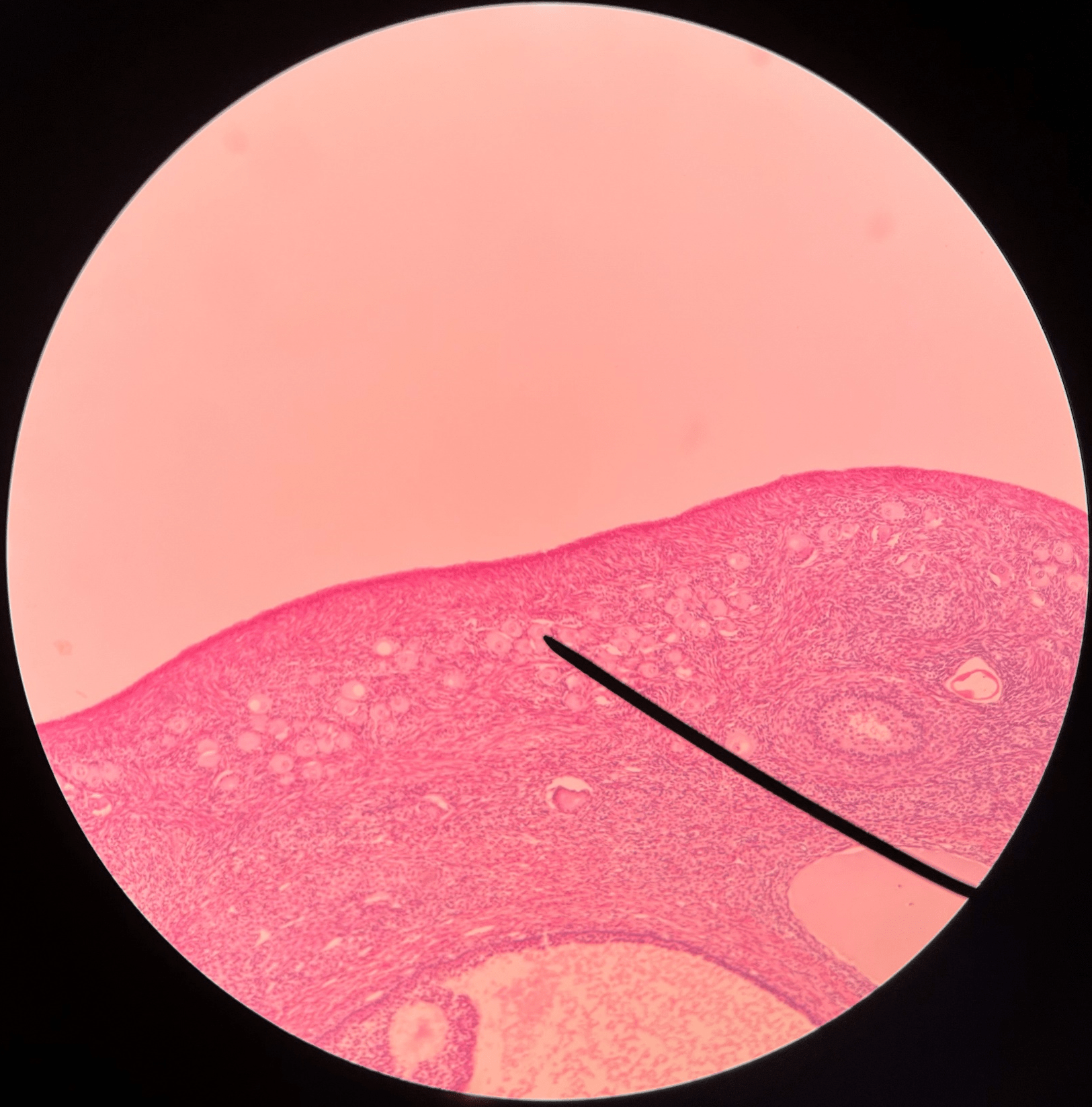 • Slide histology of the ovary.

• Composed of a single layer of follicular cells.

• Found in the outer cortex of the ovary.