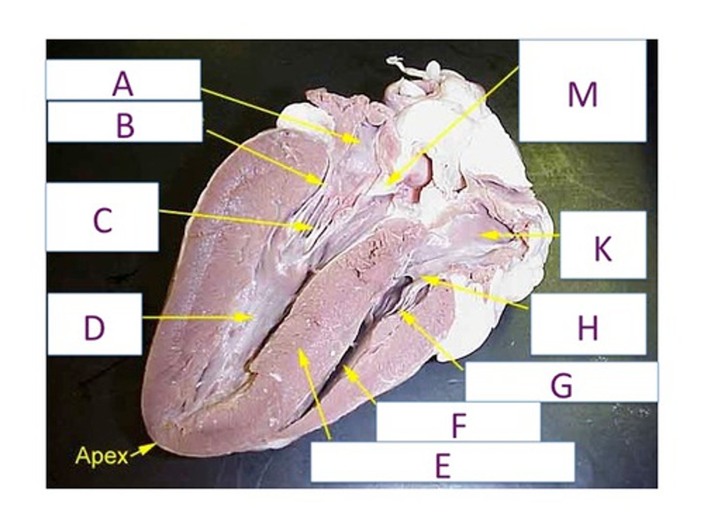 <p>What are the thin string-like structures that G and C are pointing to?</p>