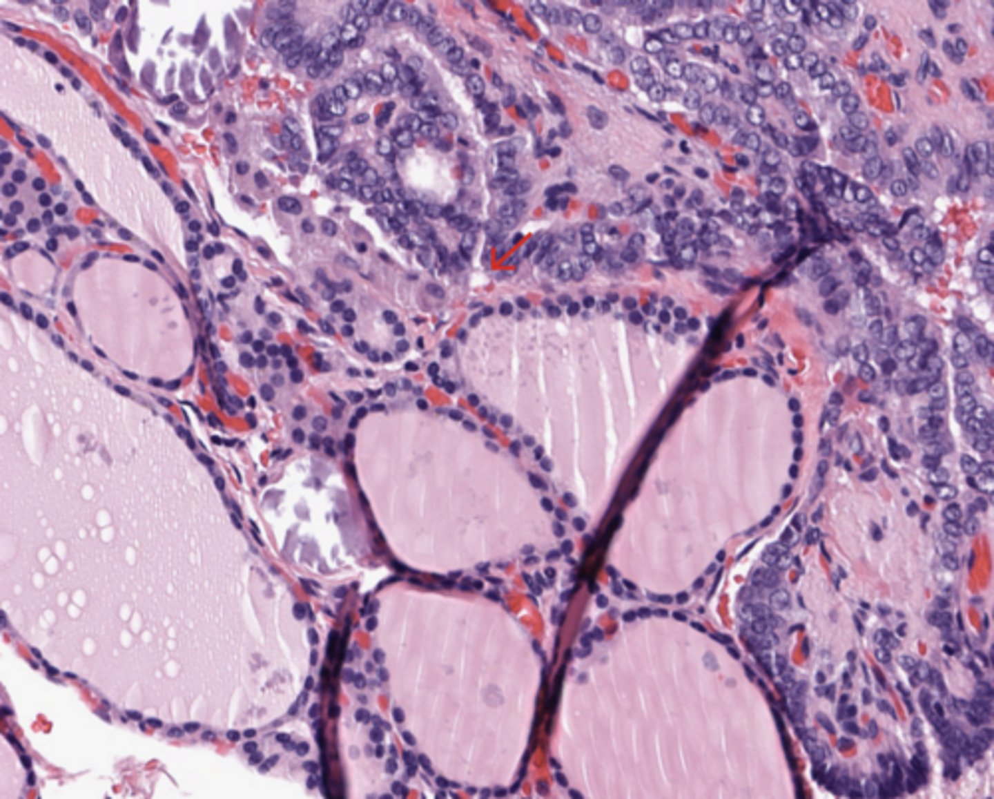 <p>Thyroid</p>