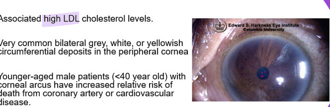 <p>caused by <mark data-color="purple" style="background-color: purple; color: inherit;">high cholesterol</mark></p>
