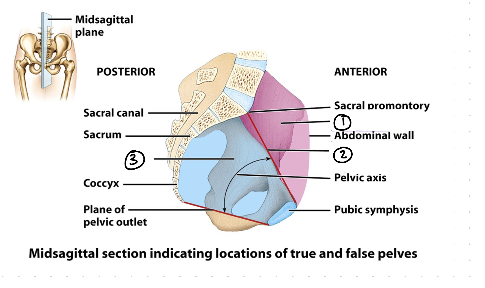 <p>true vs. false pelvis - 2 black</p>