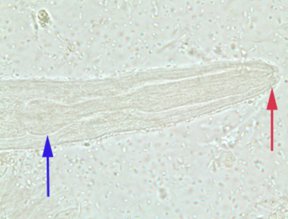 <p>short buccal cavity, long esophagus</p>