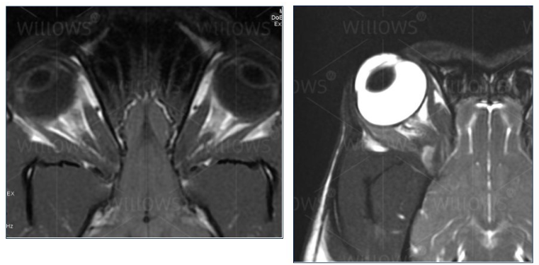 <p>Are these normal canine orbits and what diagnostic imaging tool has been used?</p>