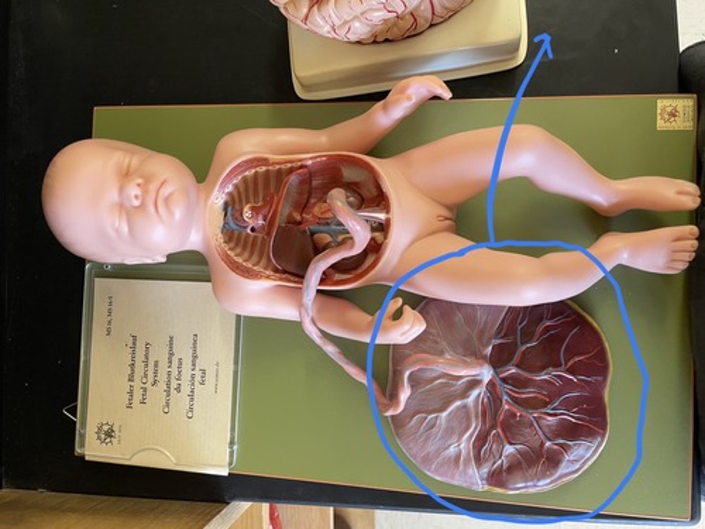 <p>A structure that allows an embryo to be nourished with the mother's blood supply</p>