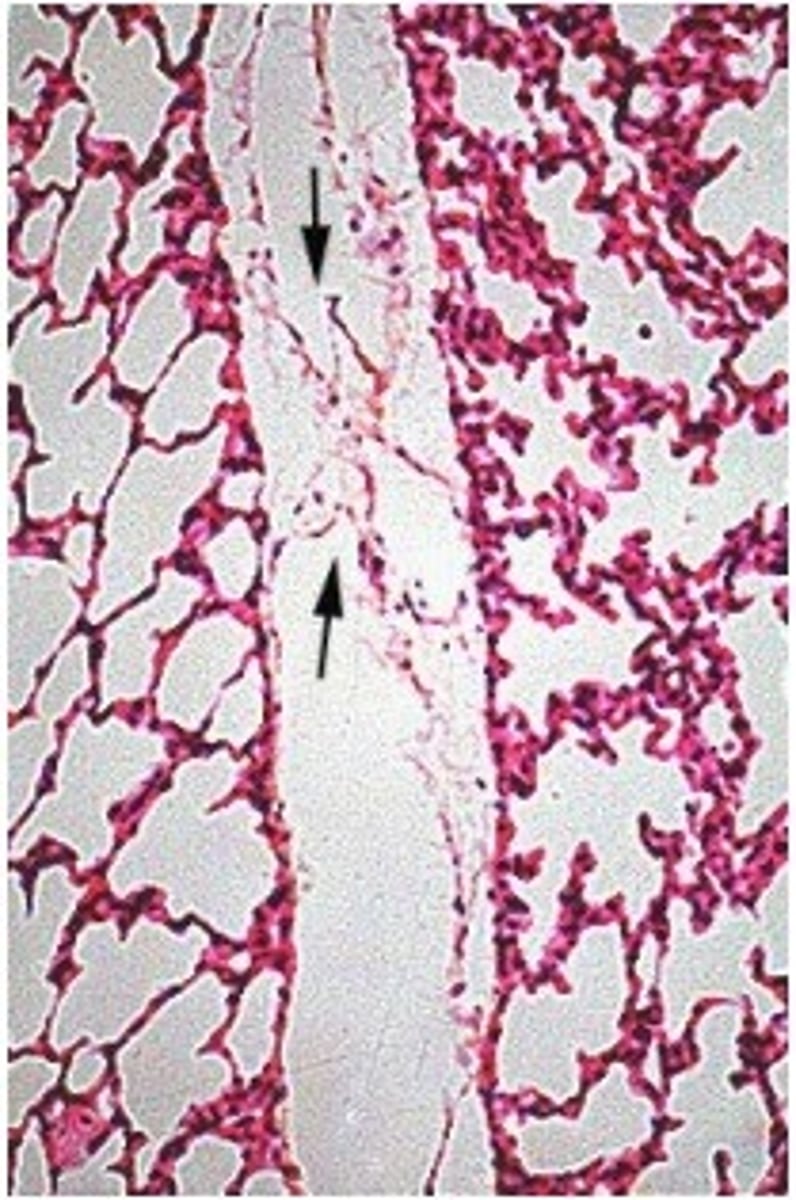 <p>Identify the vessel, describe their function and common characteristics.</p>