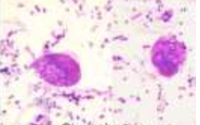 ADDITIONAL INFORMATION: Chilomastix Mesnili:

identify the stain used: 

* purple to violet in color