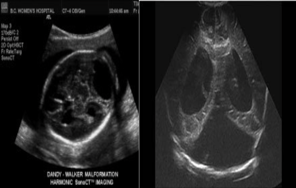 <p>What pathology is being shown?</p>