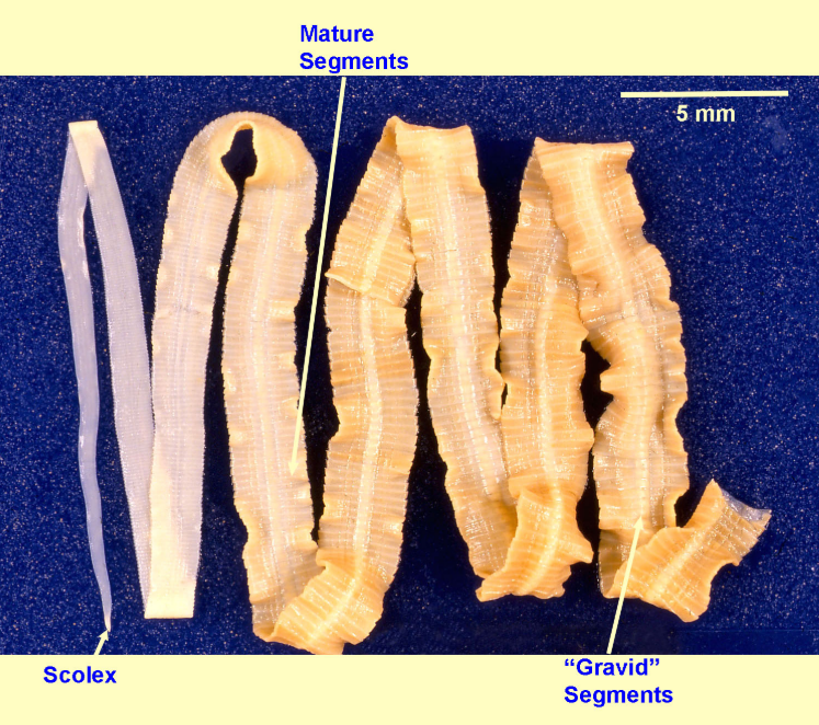 <p>Several members of the _______ family Diphyllobothriidae are known to infect humans.</p>