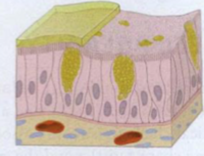 <p>Pseudostratified (Pseudolagdelt): Ligner flere lag + høje. Ses bedre i lysmykroskop?</p>