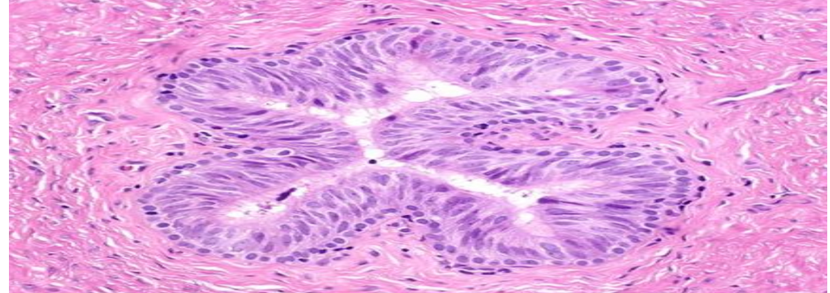 <p>Pseudostratified columnar epithelium</p>