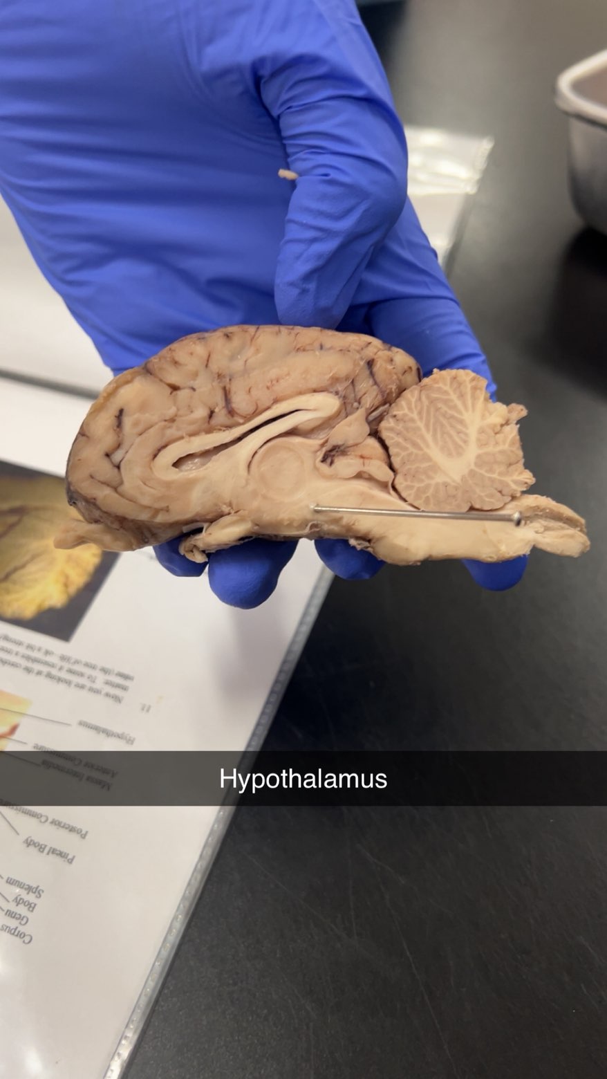 <p>hypothalamus</p>