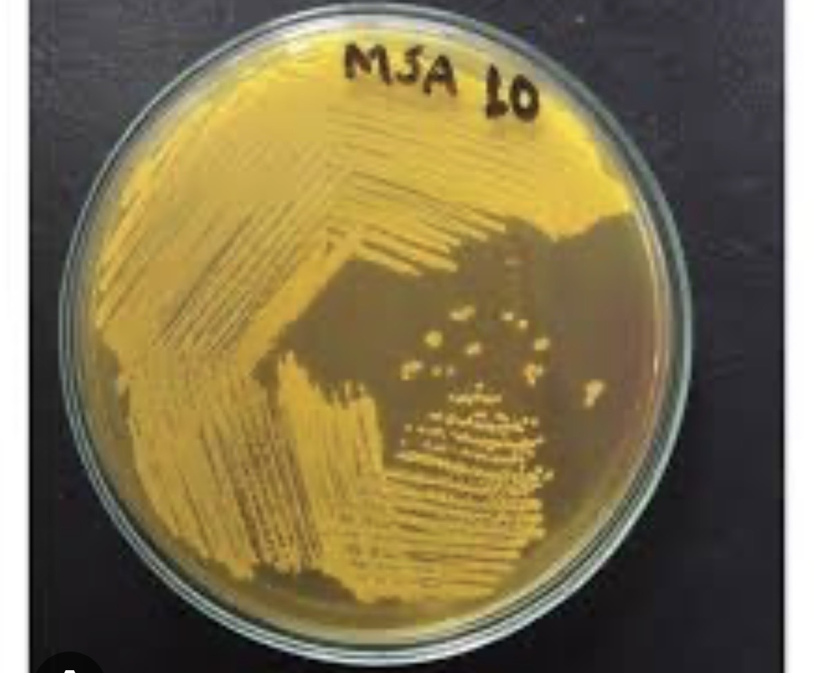 <p>What color is MSA if it can ferment &nbsp;</p>