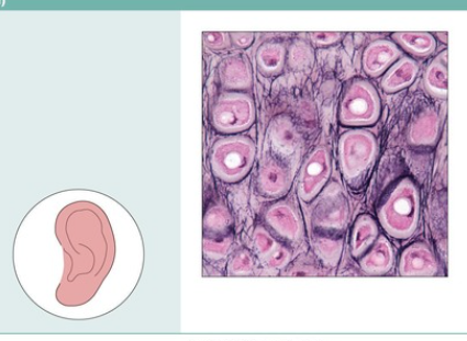 Elastic cartilage
