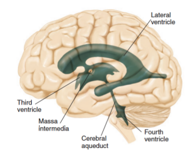 <p>ventricle</p>