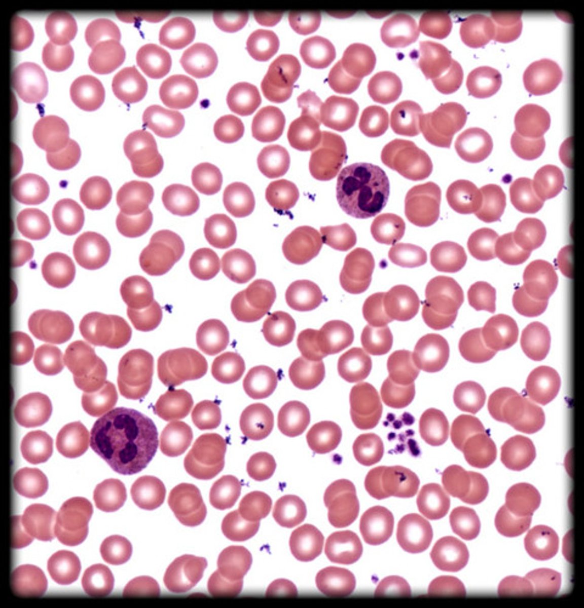 <p>- Fluid connective tissue with various cell types suspended in plasma.</p>