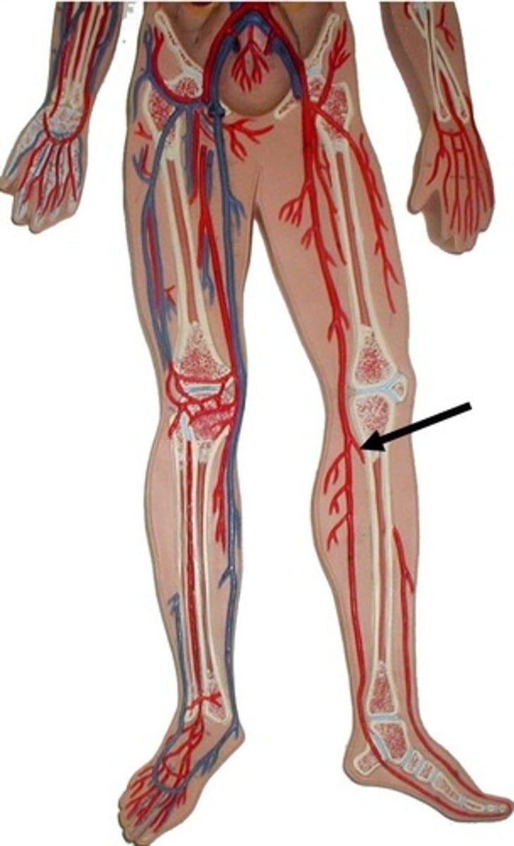 <p>**UPDATED PICTURE**</p>