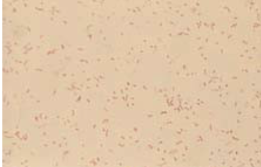<p>Aggregatibacter:</p>