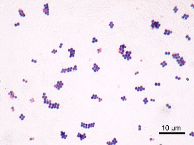 <p>How would you report this stain?</p>