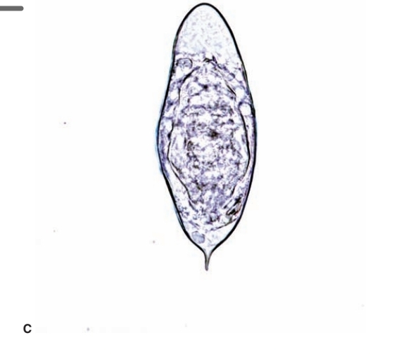 <p>Terminal spine</p>