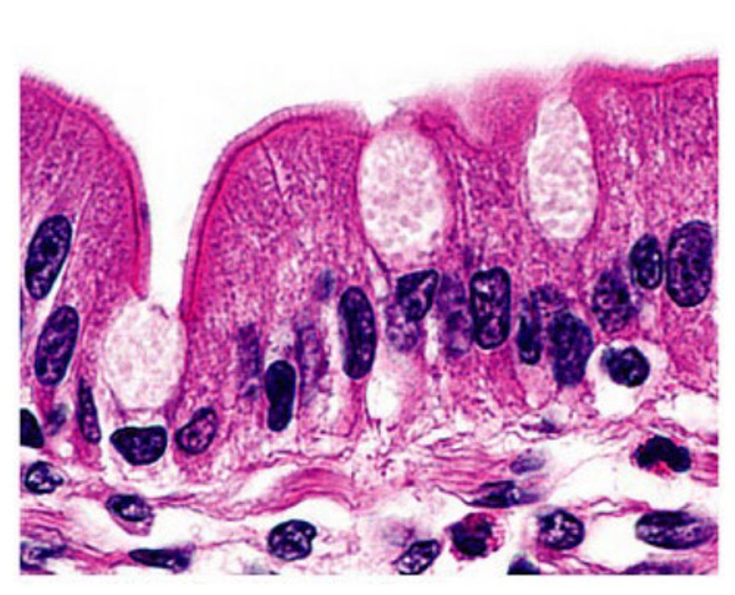 <p>Nonciliated simple columnar epithelium</p>