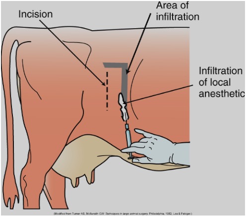 <p>Standing, through left flank incision with local anesthetic block.</p>