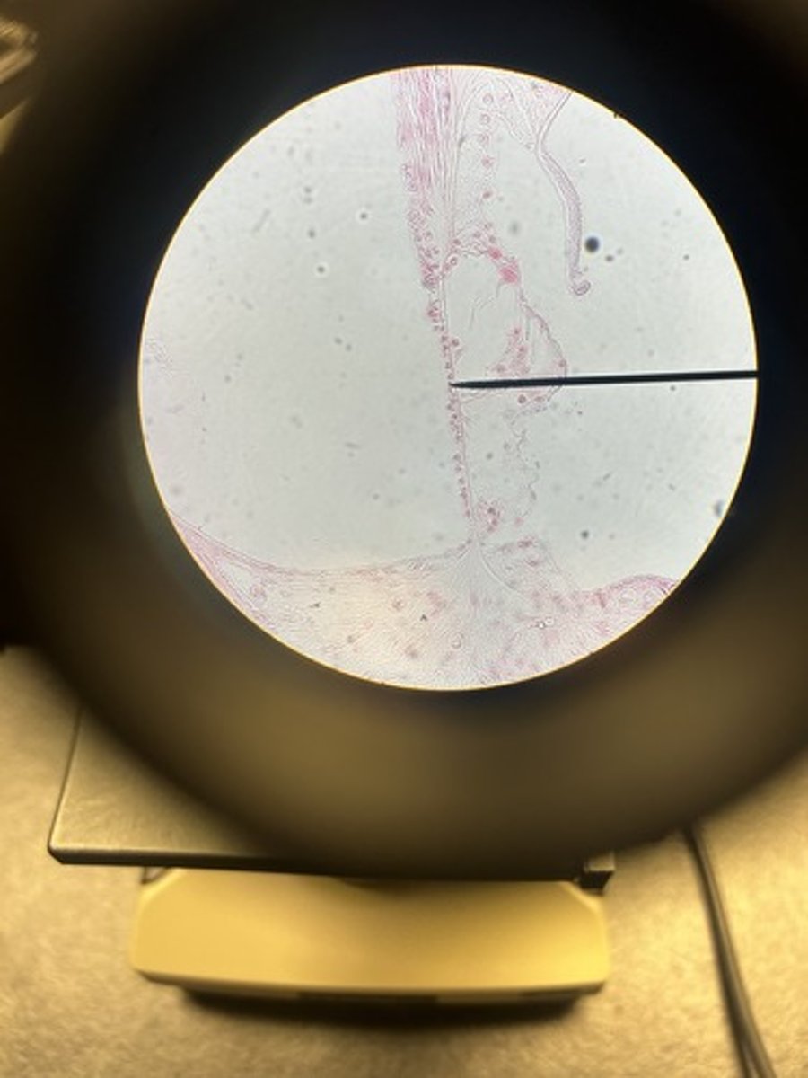 <p>- basilar membrane (left most line)</p><p>- hair cells (3 lines in the gap)</p><p>- tectorial membrane (upside down lookin peninsula)</p>