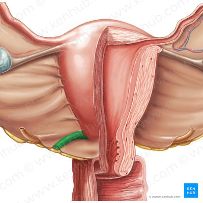 <p>Dây chằng tử cung cùng (Uterosacral ligament)</p>