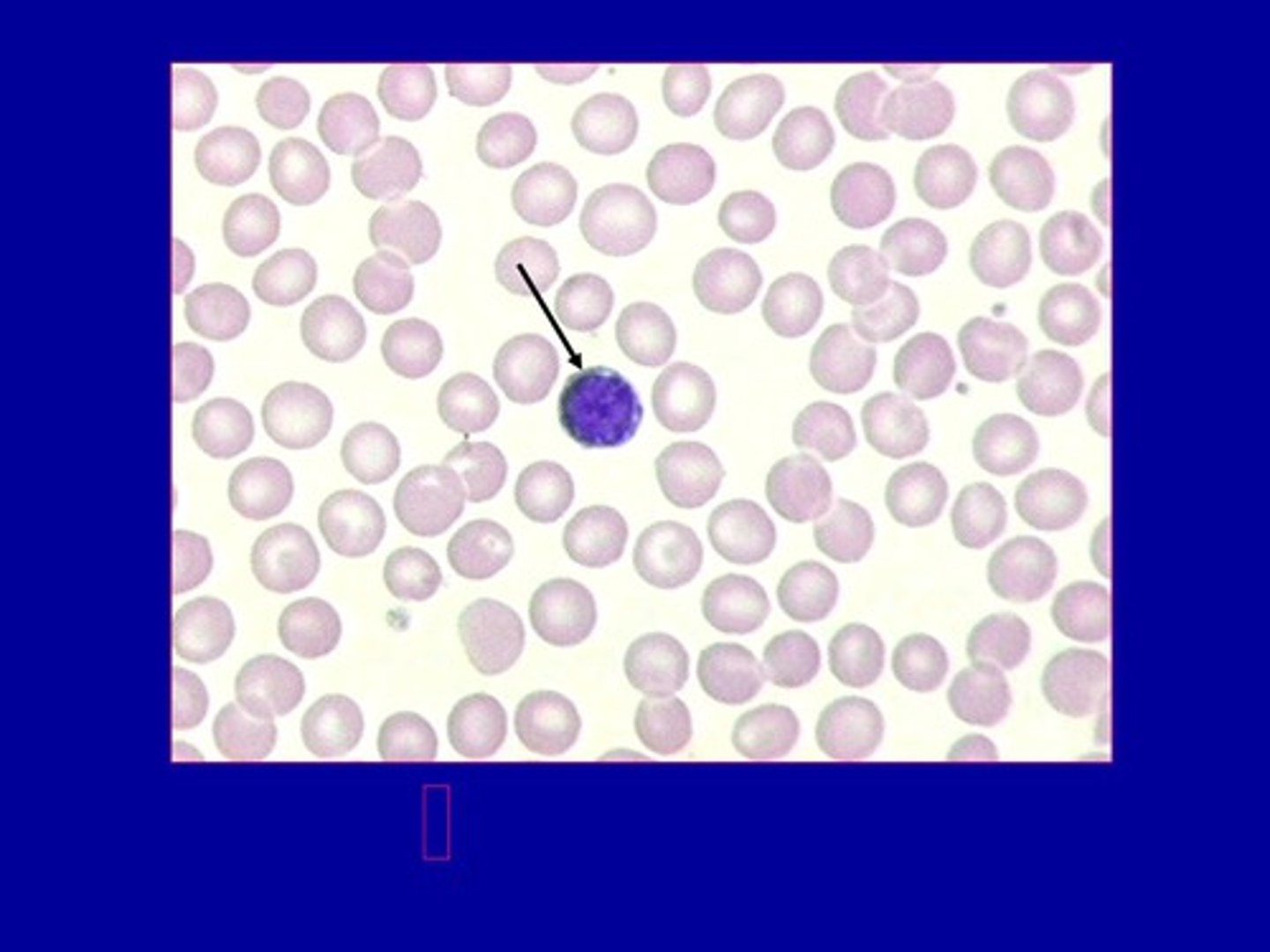 <p>white blood cells</p>