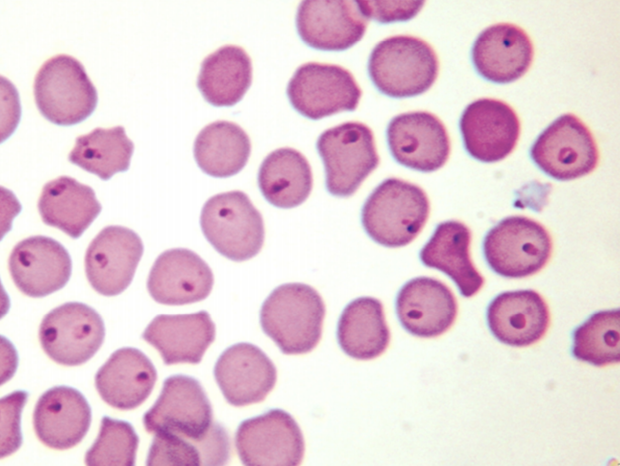 <p><span>A male DSH presents w/acutely recumbent, inappetent, icteric &amp; the RBC have round-oval pear shaped organisms, diagnosis?</span></p>