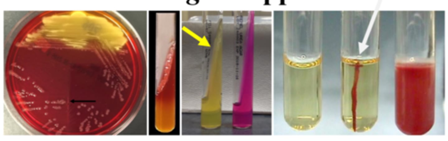 <p>-Non-lactose fermentation</p><p>-Growth on selective agar</p><p>-H2S-negative</p><p>-Urease-negative</p><p>-non-motile</p><p>-#3 bacterial GI pathogen </p><p>-transmission: fomites, fingers, fleas, feces </p>