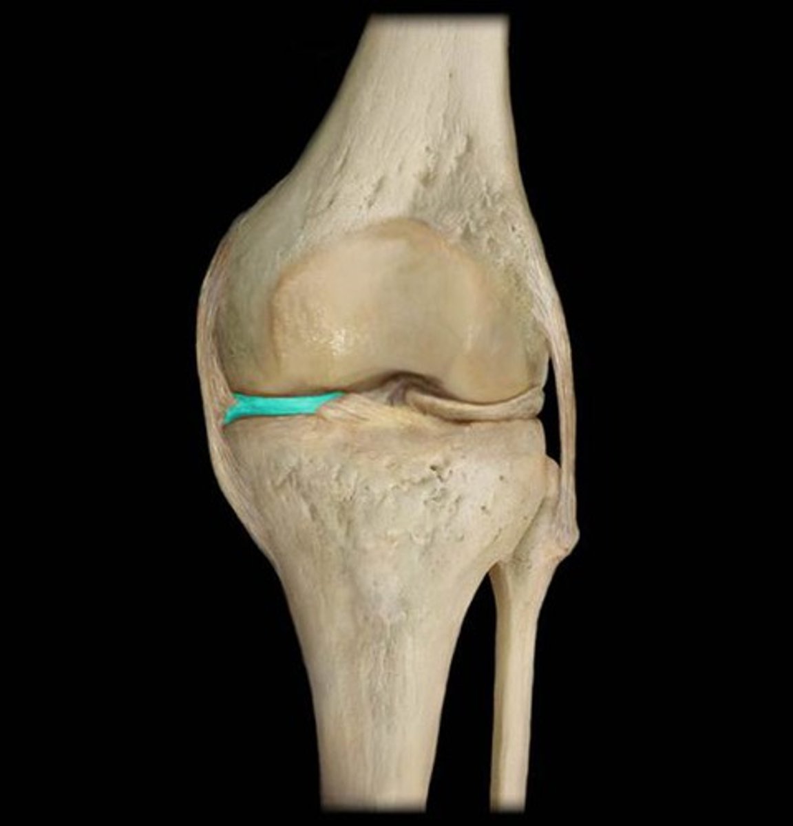 <p>Identify this fibrous cartilage pad.</p>