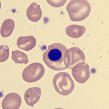 <p>What is this erythrocyte?</p>