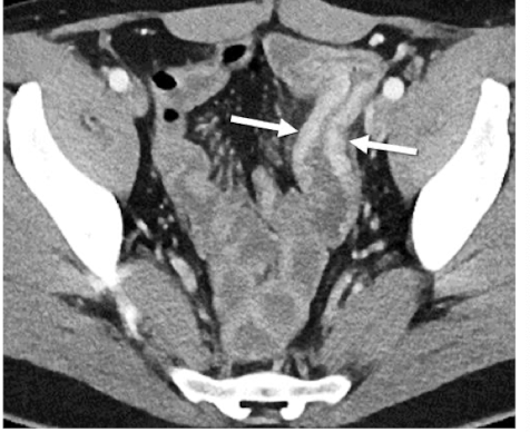 <p>What is this and what type of scan </p>