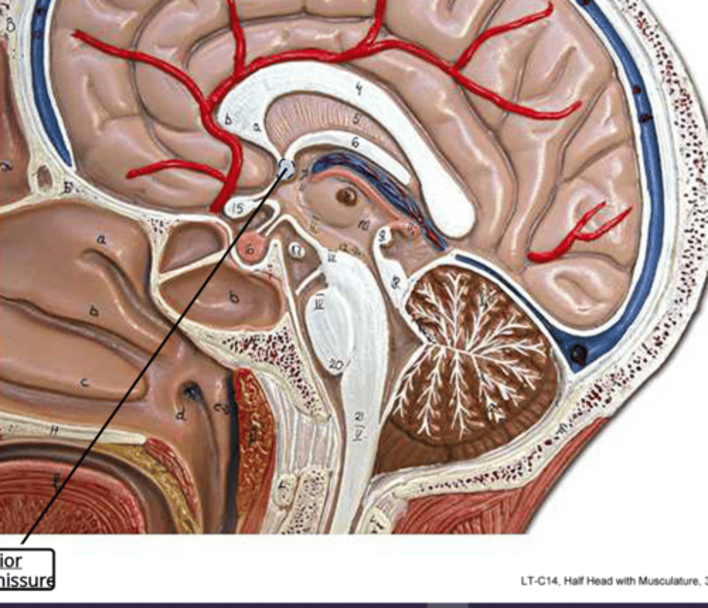 <p>connects the anterior parts of the cerebral cortex</p>