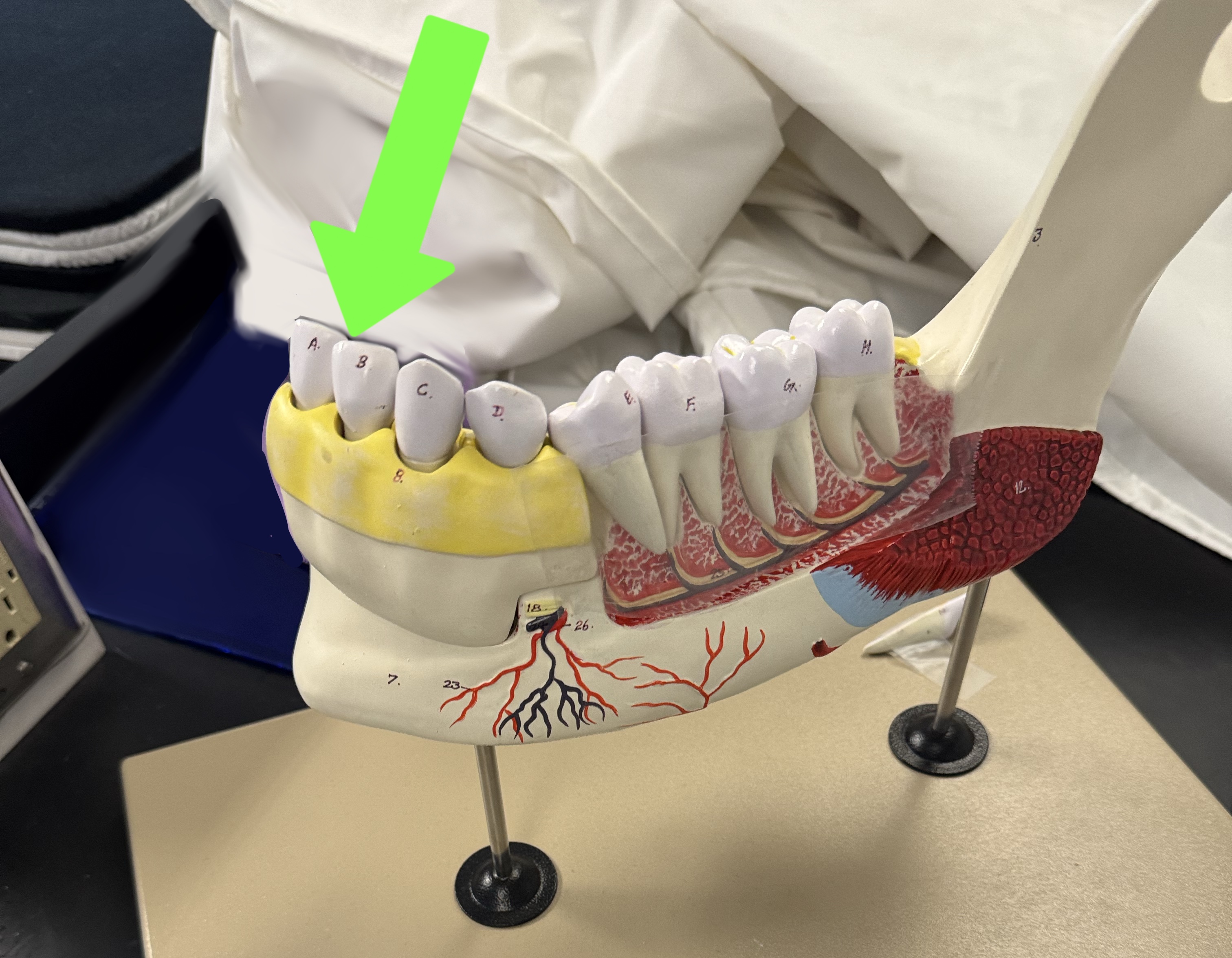 <p>what type of tooth is this</p>