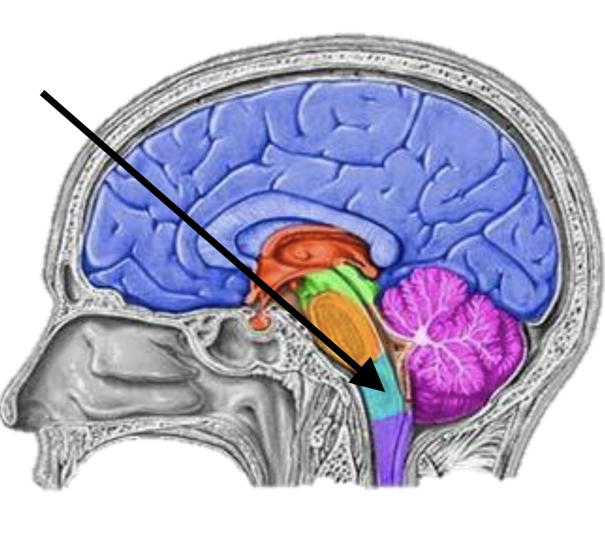 <p>Name the brain structure</p>