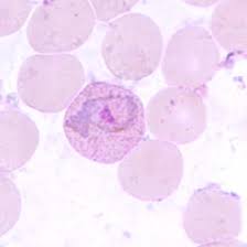 Late trophozoite Plasmodium vivax