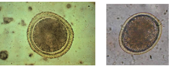 <p>Nematodes - Ascarids</p><p>Roundworm</p>