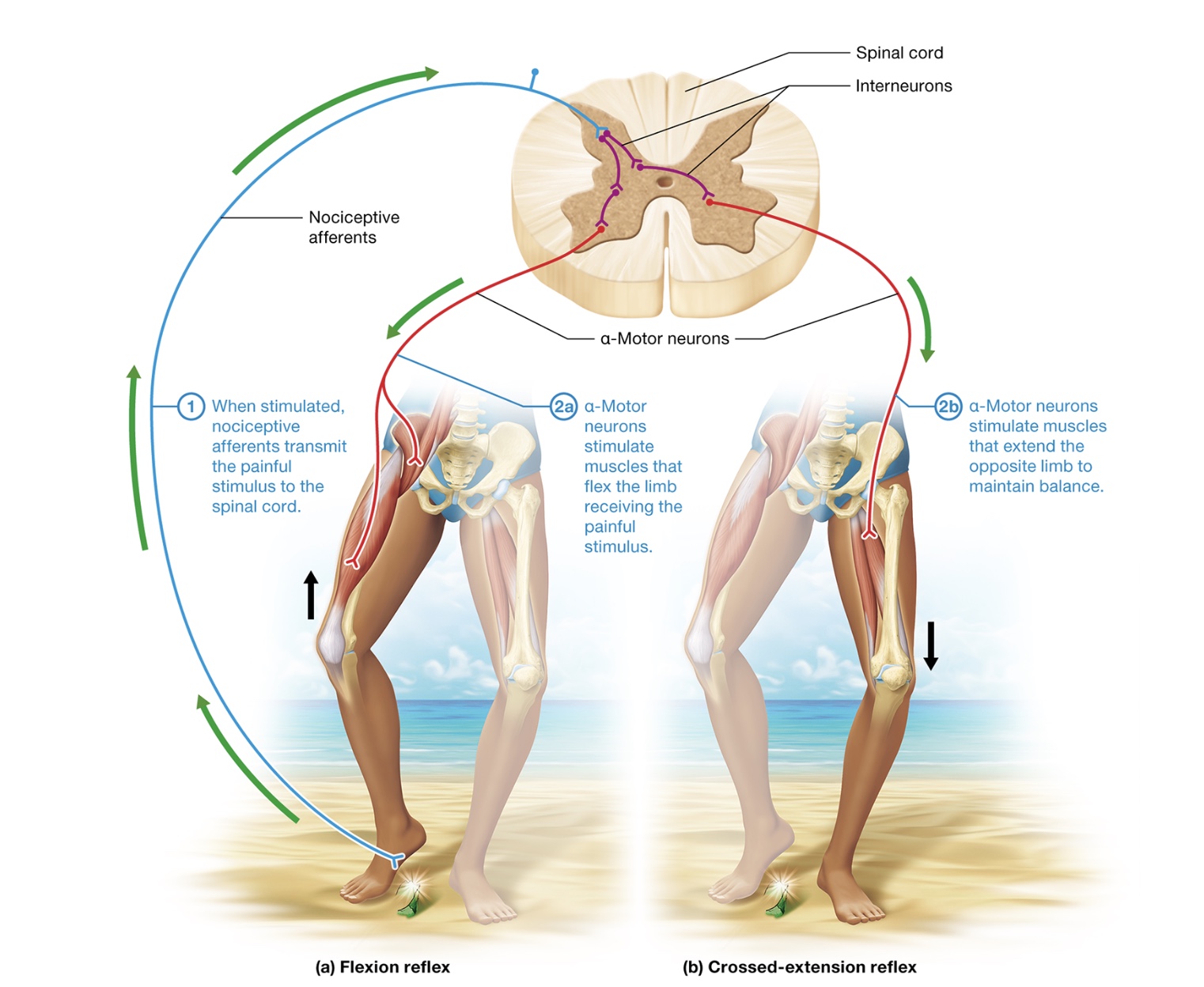 <p>flexion withdrawal + crossed extension</p>
